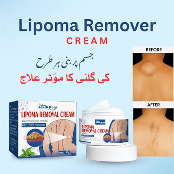 Lipoma Removal Cream In Pakistan thumbnail 2
